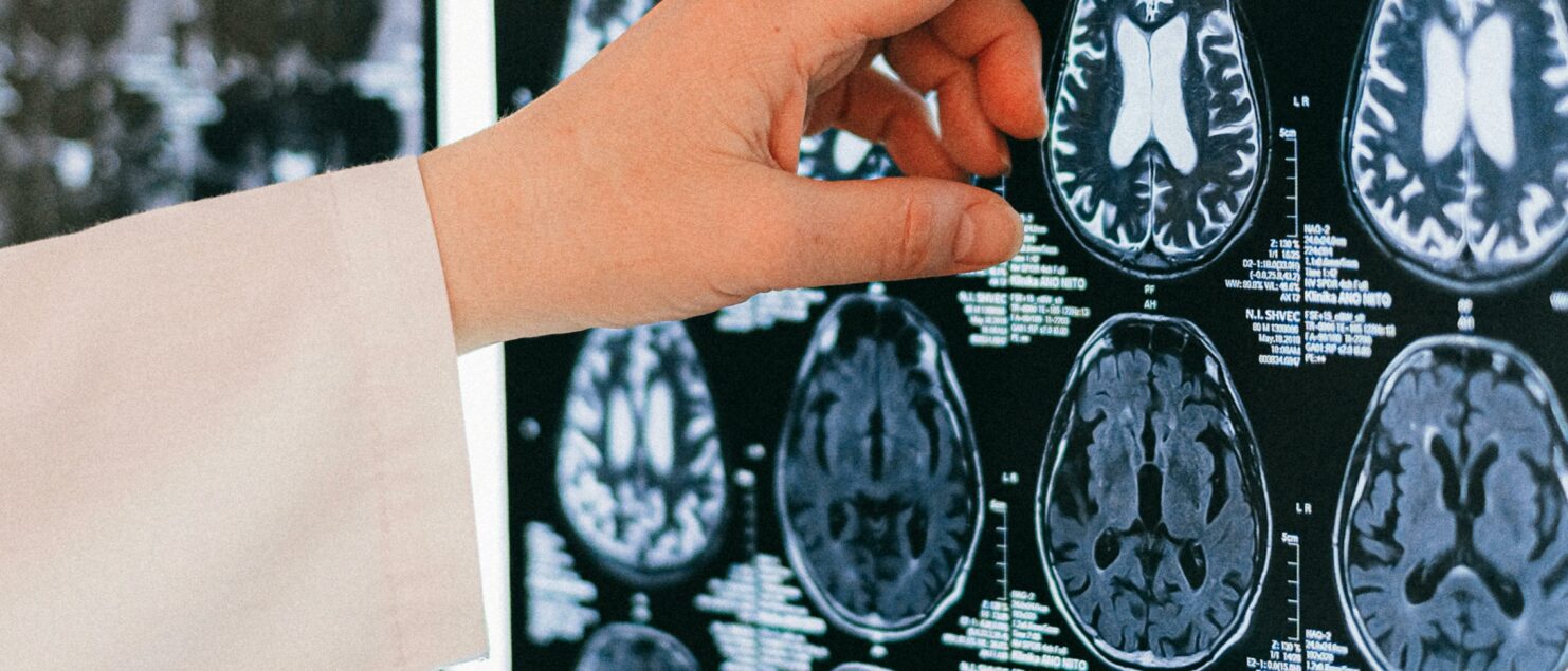 IA e medicina