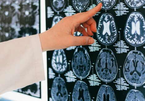 IA e medicina